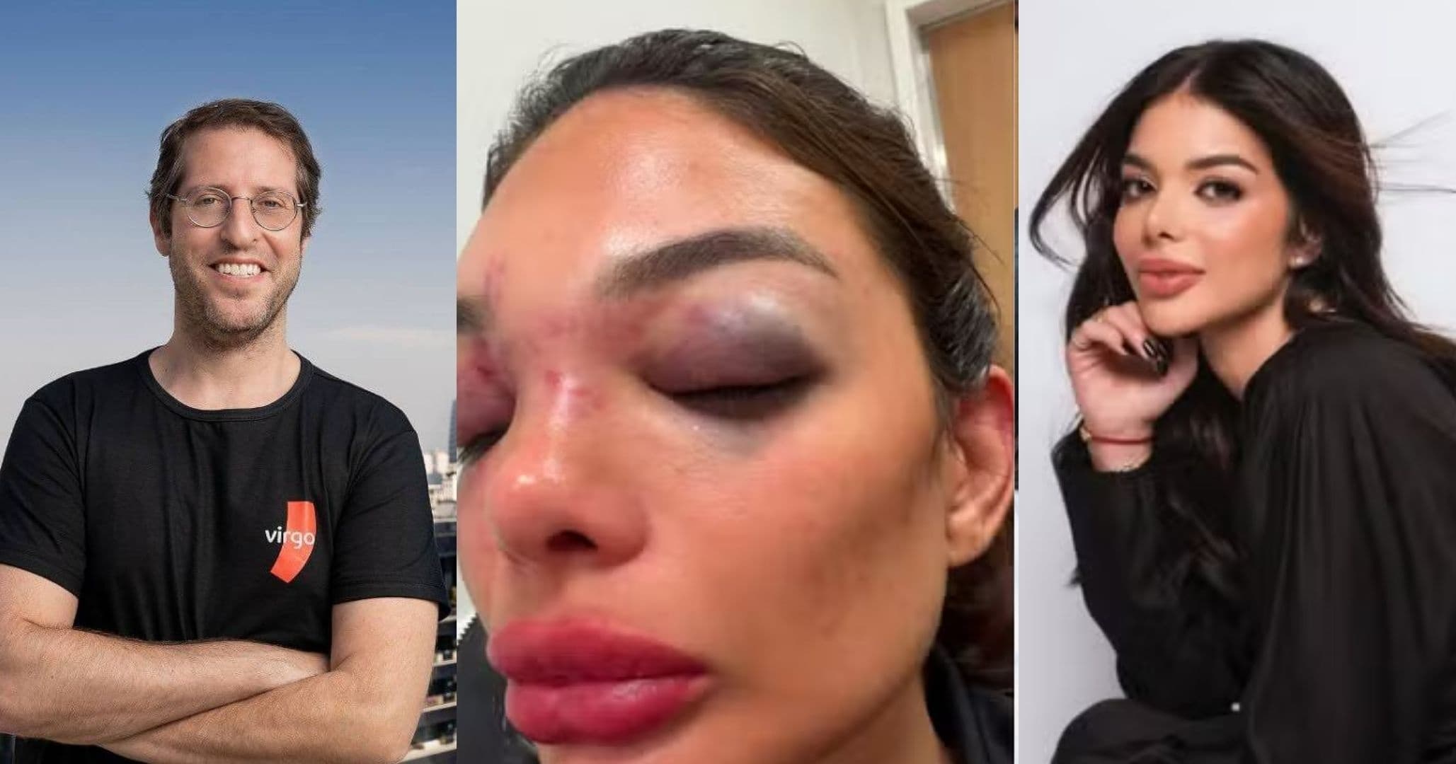 Empresário Ivo Vel Kos tem prisão preventiva decretada após agredir esposa com taco de beisebol 