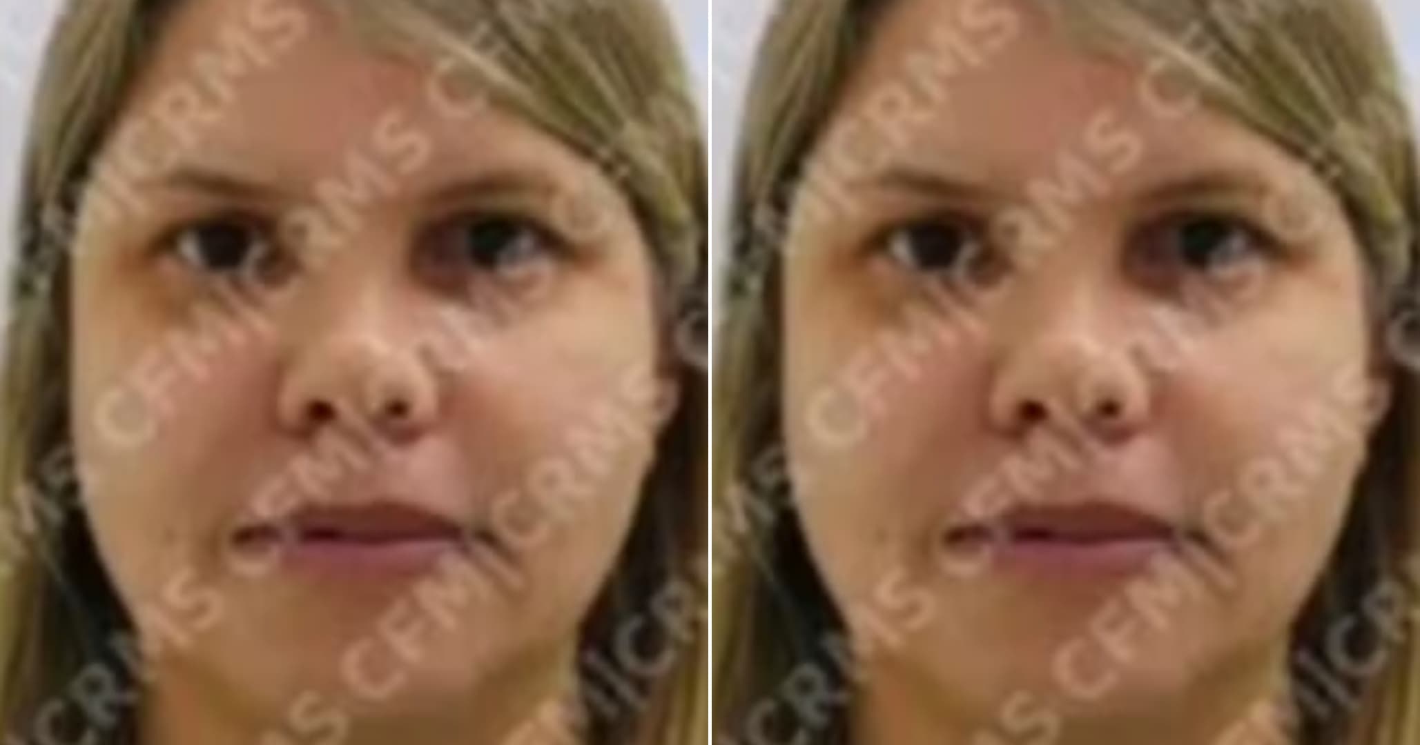 Médica presa suspeita de integrar grupo responsável por falsificar diplomas de medicina é solta dez dias após prisão