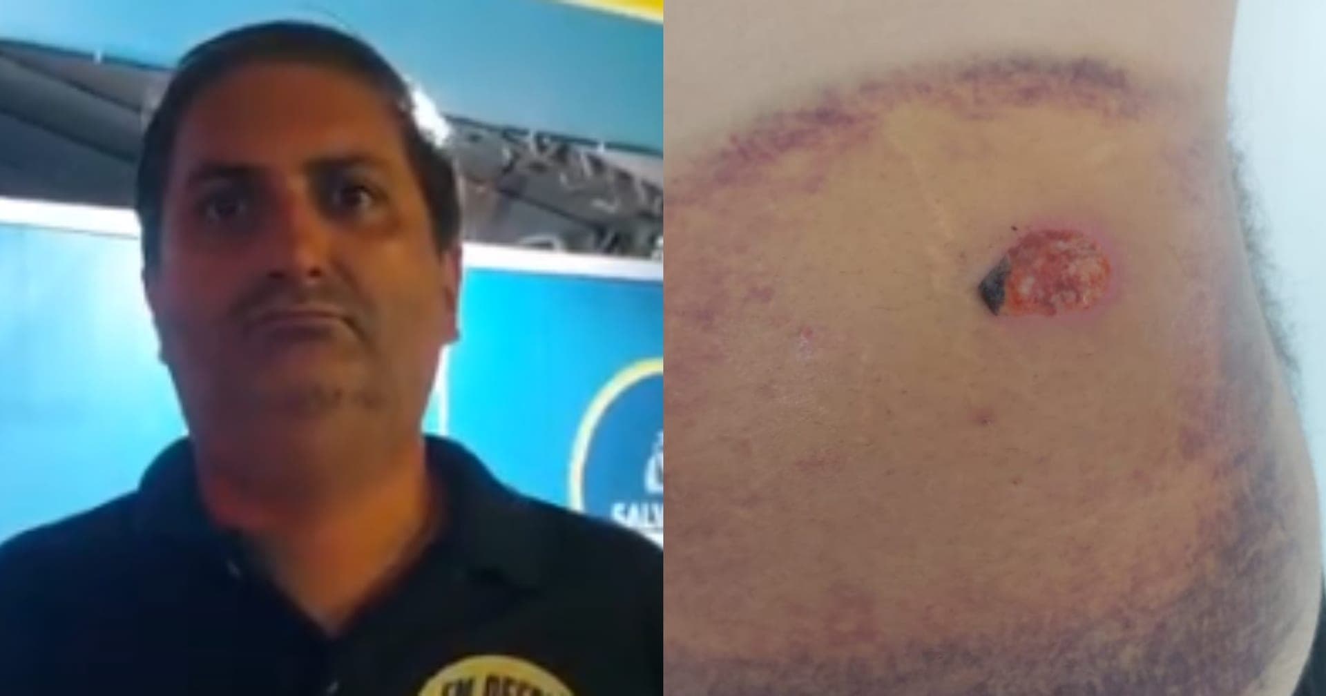 Candidato da UP ao governo da Bahia segue com agenda limitada após ser baleado por bala de borracha da PM 